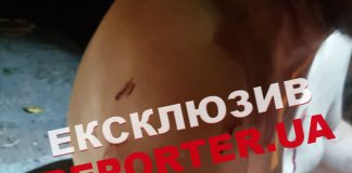 “РЕПЕРТЕР” – Звинуватив у крадіжці: У Дніпрі до лікарні доставили чоловіка з численними ножовими пораненнями