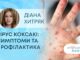 ЯК ЗДОРОВ’Я? ВІРУС КОКСАКІ: СИМПТОМИ ТА ПРОФІЛАКТИКА
