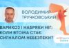 ЯК ЗДОРОВ`Я: ВАРИКОЗ І НАБРЯКИ НІГ: КОЛИ ВТОМА СТАЄ СИГНАЛОМ НЕБЕЗПЕКИ?