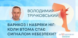 ЯК ЗДОРОВ`Я: ВАРИКОЗ І НАБРЯКИ НІГ: КОЛИ ВТОМА СТАЄ СИГНАЛОМ НЕБЕЗПЕКИ?