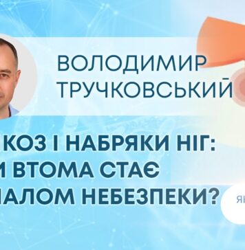 ЯК ЗДОРОВ`Я: ВАРИКОЗ І НАБРЯКИ НІГ: КОЛИ ВТОМА СТАЄ СИГНАЛОМ НЕБЕЗПЕКИ?